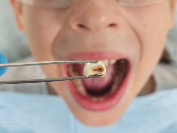 Best Chipped Tooth Repair Near Me  in Moorestown Lenola, NJ